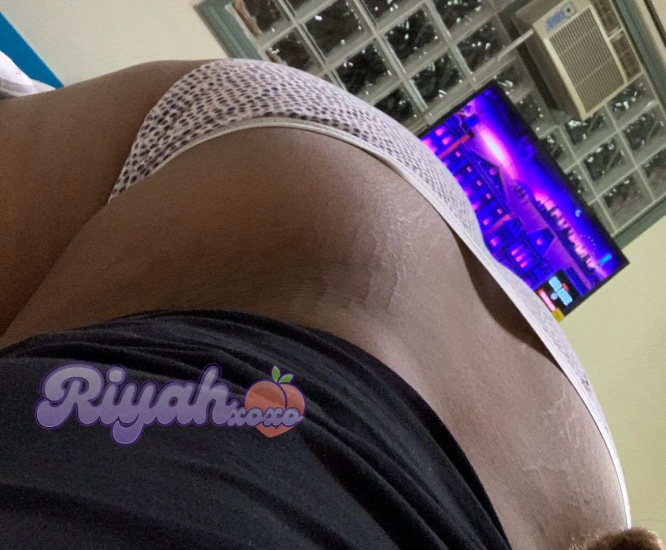 Do you like stretch marks? 