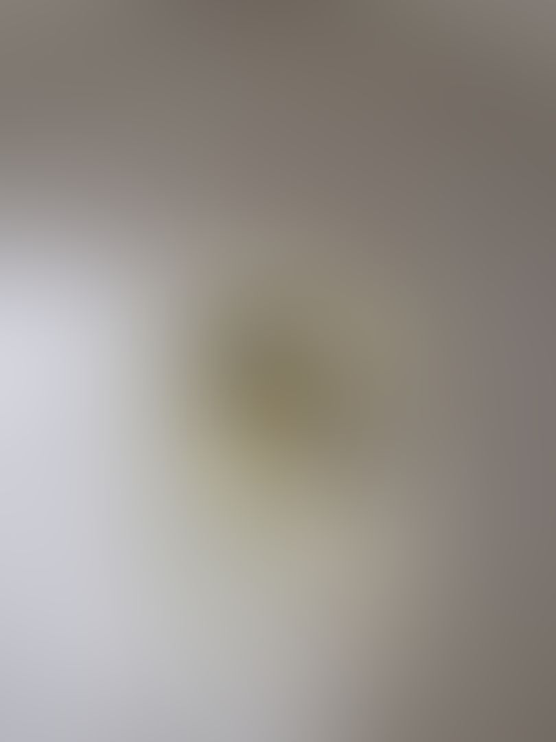 1st pic: My tiny poops. 2nd pic: blood warning ⚠️ 