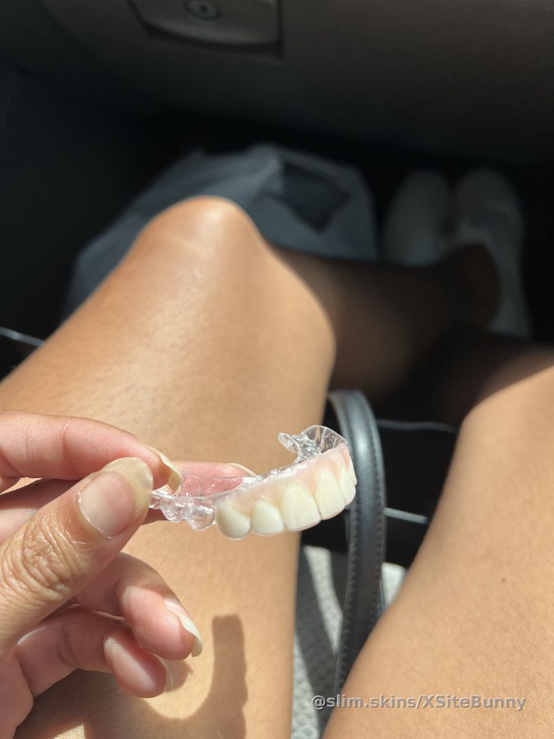 I have surgery scheduled in November. Until then, it’s gums for me 😋💜