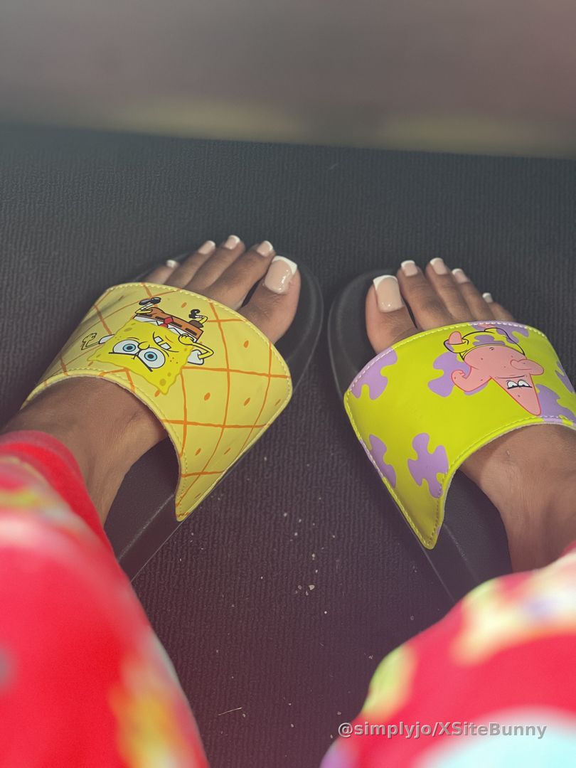 Everyone loves French tip toes I’m healing great yall I should be back to work soon