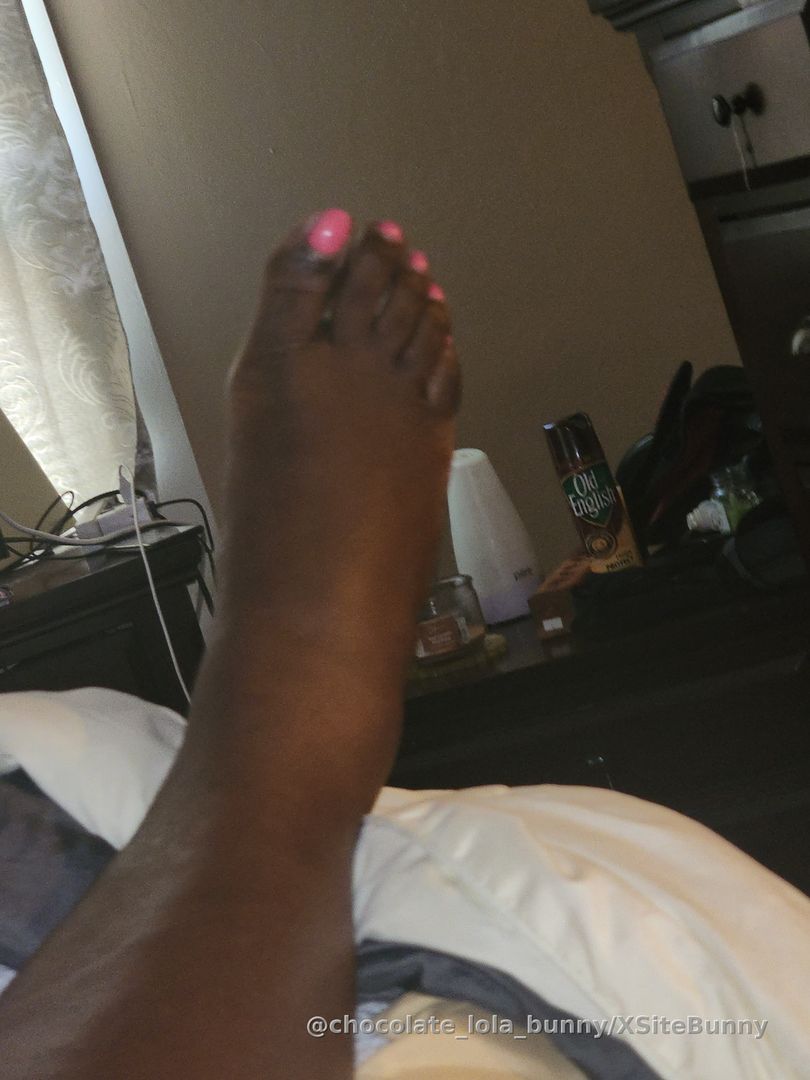 Swollen foot, #feetflick