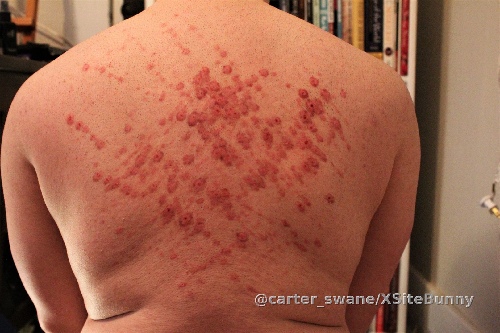 The delish marks the day after having been whipped! This was from the second time I was ever whipped and I always love how my marks turn out. 